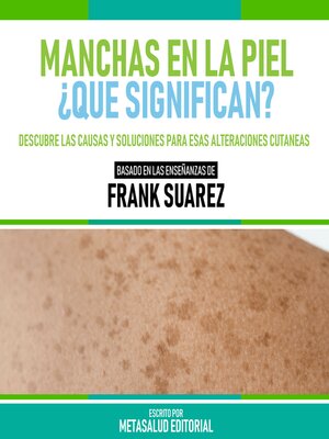 cover image of Manchas En La Piel--¿Qué Significan?--Basado En Las Enseñanzas De Frank Suarez